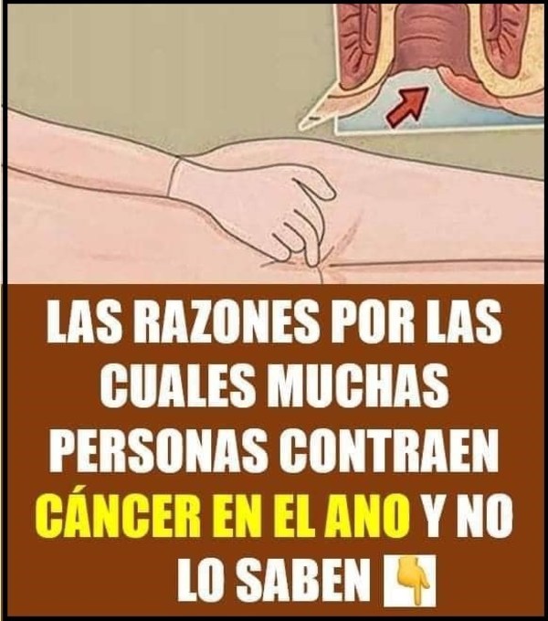 Cáncer del recto es un tipo raro y muy difícil de curar