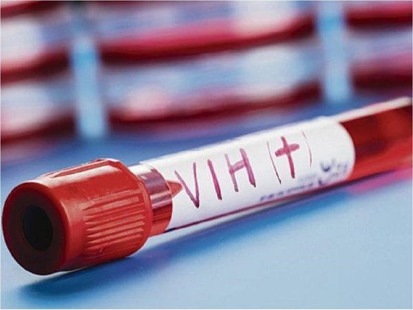 Confirman el segundo paciente en el mundo que se cura del VIH