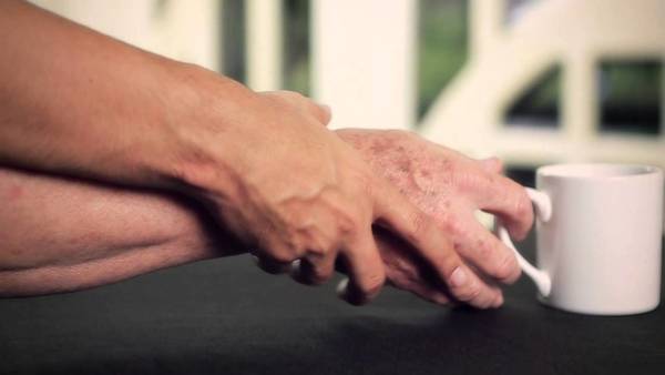 Seis dudas frecuentes para entender el Glaucoma, una enfermedad silenciosa que puede llevarnos a la ceguera » Ñanduti