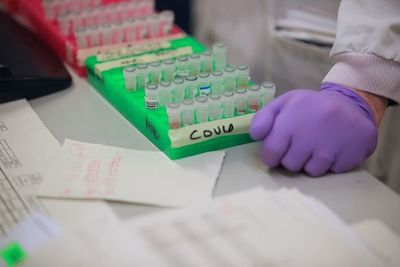 Las farmacéuticas de EEUU, en una carrera contrarreloj frente al coronavirus - Mundo - ABC Color