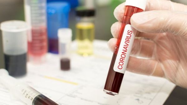 Son 4 los casos sospechosos de CORONAVIRUS en FOZ, pero podrían ser muchos