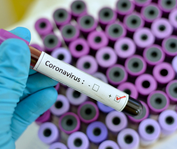 Coronavirus: Paraguay confirma sexto caso y toma medidas