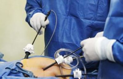 Dr. Juan Barboza especialista en cirugía laparoscópica