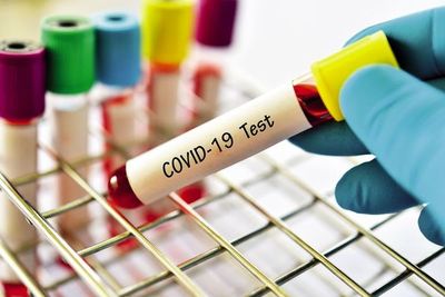 La prevención es la mejor medida para evitar el covid-19, según especialistas - Nacionales - ABC Color