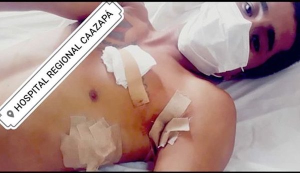 Volái quiso seguir la farra y baleó al músico | Crónica