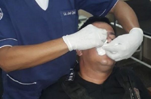 Coronavirus: Imputan a tres hombres por agredir a policías