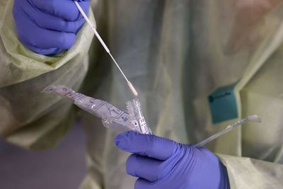OMS pide que se hagan pruebas hasta a los casos leves de coronavirus - Mundo - ABC Color