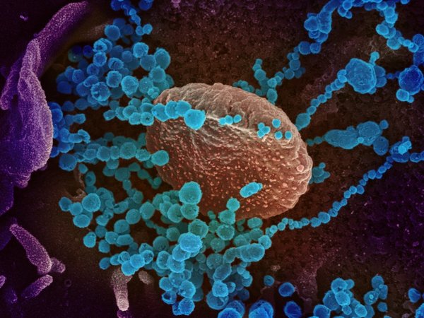 Mala coagulación, otro factor de riesgo mortal del Covid-19