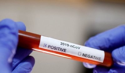 PARAGUAYO DIAGNOSTICADO CON CORONAVIRUS FALLECIÓ EN ESPAÑA