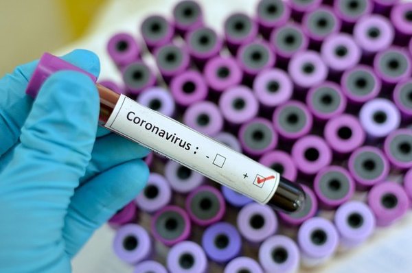 Laboratorios privados aún no están autorizados para realizar pruebas de coronavirus