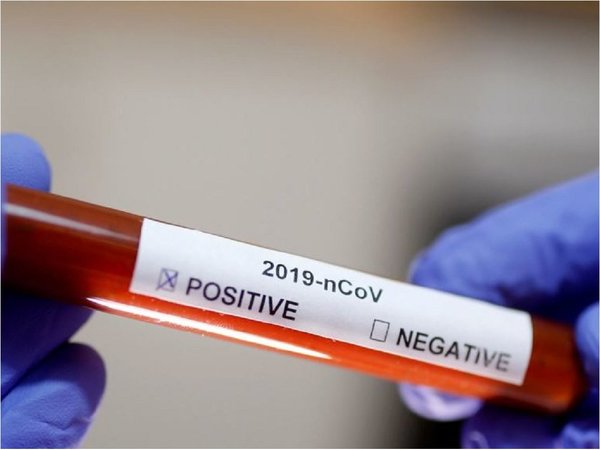 Coronavirus: Laboratorio Central solo puede realizar 30 test por día
