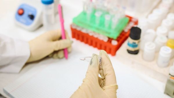 ¿Qué es, cómo y cuándo se realiza la prueba para detectar el COVID-19?