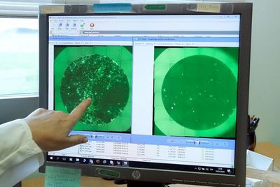 Científicos estudian a contrarreloj al virus - Internacionales - ABC Color