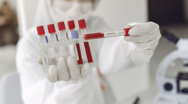 Infectólogos urgen celeridad a Salud en pruebas del COVID-19
