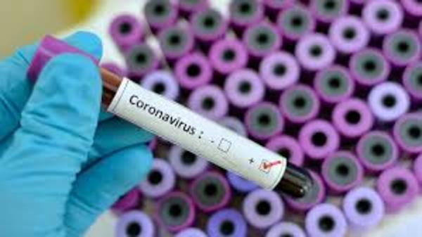 Coronavirus: casos positivos se mantienen en 22 y son de Asunción, Central y Cordillera | Radio Regional 660 AM