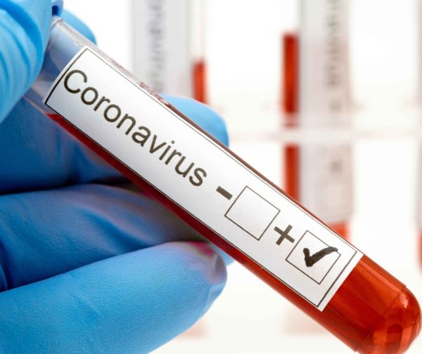 Tercera muerte por coronavirus en Paraguay