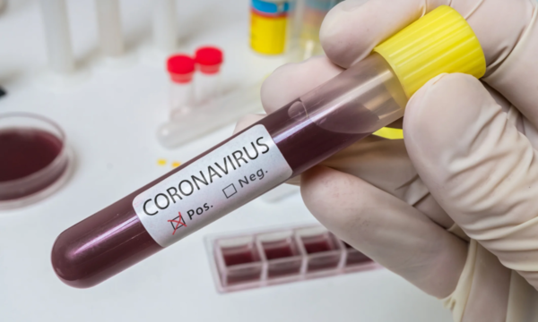 Según subregistro, se estima que habría 370 casos de coronavirus