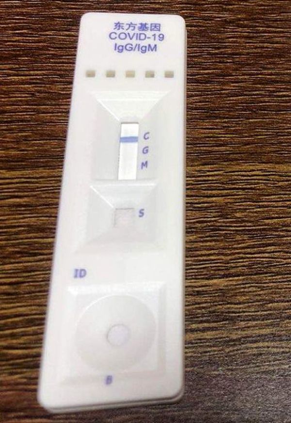 Ministerio desmiente la compra de test rápidos - Locales - ABC Color