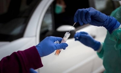 HOY / Consorcio alemán Bosch desarrolla test rápido para el coronavirus