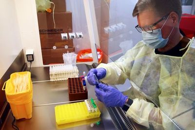 Situación “frustrante” por incapacidad de aumentar número de test y adelantan que hay muchos más casos de COVID-19 - Nacionales - ABC Color