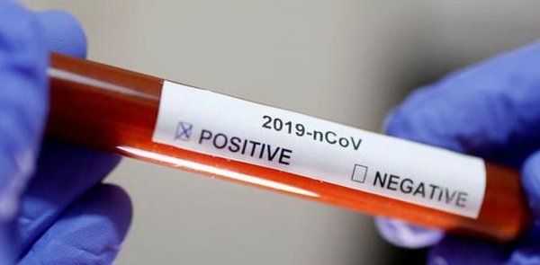 Coronavirus: ya son 41 los positivos | Radio Regional 660 AM