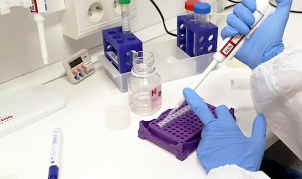 Consorcio alemán Bosch desarrolla test rápido para el coronavirus