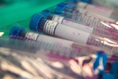 Compran miles de tests fallados para el COVID-19