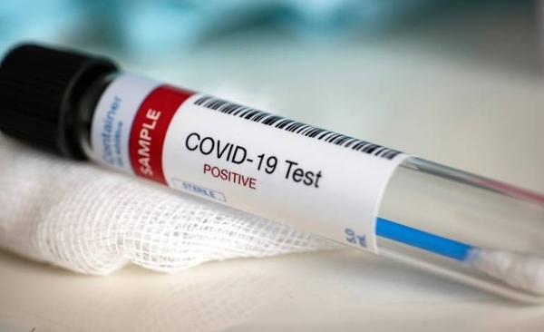 HOY / Con más centros públicos certificados, aumentará capacidad de detección de COVID-19