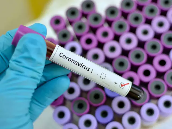 Covid-19: Aumentan a 59 los casos de coronavirus en el país