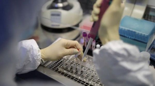 Donarán 10.000 kits de testeos de coronavirus al Ministerio de Salud - Digital Misiones