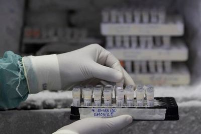 La ciencia trabaja ya en 20 vacunas y en 30 medicamentos potenciales - Ciencia - ABC Color