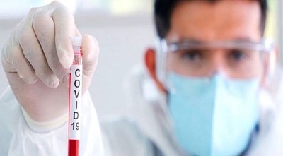 Donan 5.000 test para “pillar” el Covid-19, a Salud | Crónica
