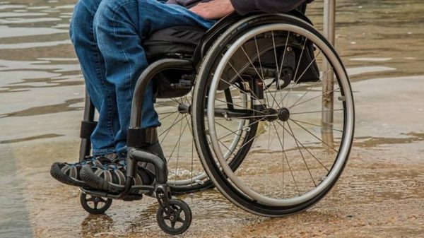 El 40% de las personas con discapacidad son afectadas por la crisis causada por el COVID-19 » Ñanduti