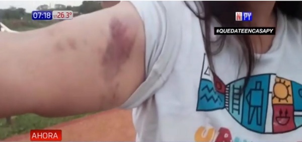 Mujer denuncia a sus vecinos por brutal agresión | Noticias Paraguay