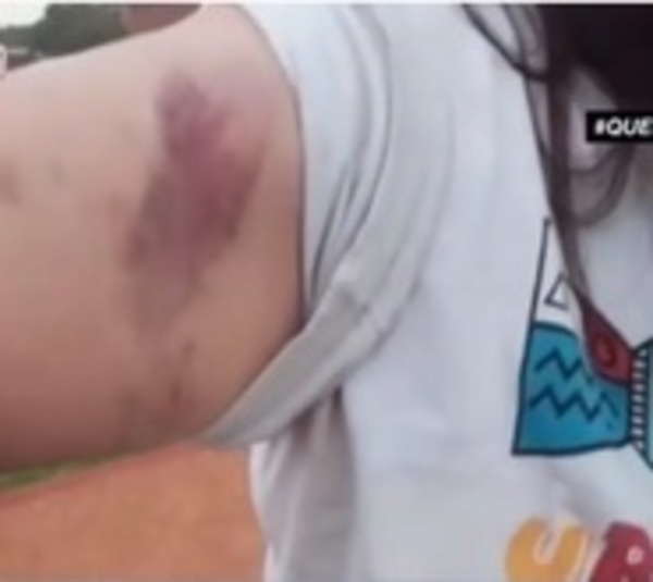 Mujer denuncia a sus vecinos por brutal agresión - Paraguay.com