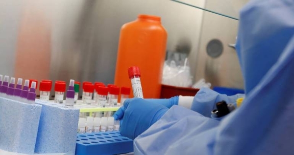 HOY / COVID-19: En un mes Salud procesó 1078 muestras, cantidad que debería ser diaria para conocer cifra real de casos