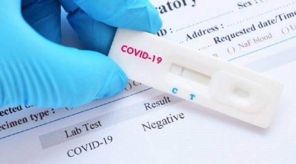 HOY / Coronavirus llegó al Chaco, se confirma un caso en Boquerón