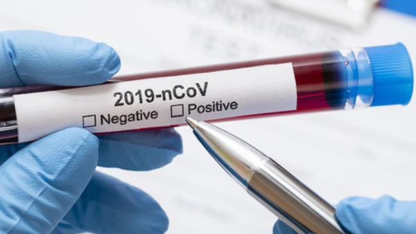 Se confirmó el primer caso de coronavirus en el Chaco