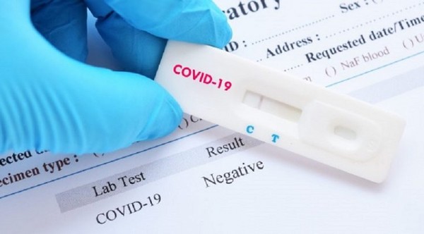 Un nuevo recuperado de coronavirus en Paraguay: ya son tres » Ñanduti