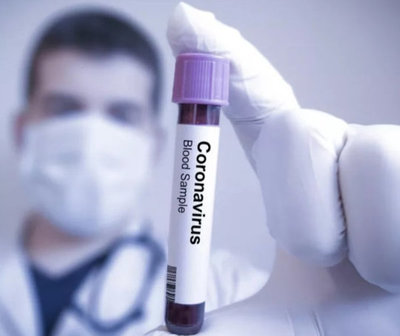 Suben a 92 los casos confirmados de COVID -19