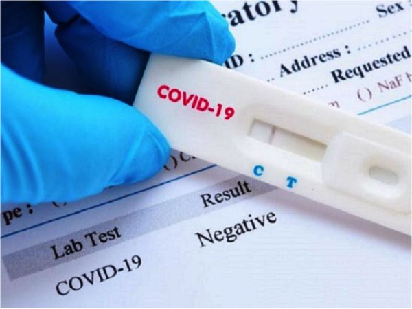 El 30% de  test de coronavirus puede arrojar falsos negativos