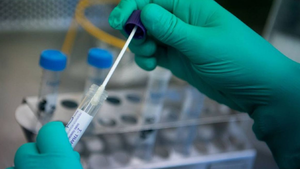 Según un estudio alemán, el COVID-19 se propaga mil veces más en la garganta que el virus del SARS