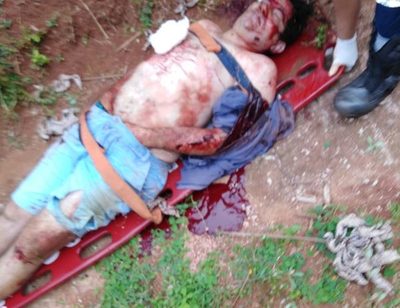 Imputan a hombre que baleó a policía y que también resultó herido en tiroteo – Diario TNPRESS