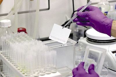 Hallazgo científico sugiere que fármaco antiparasitario inhibe reproducción del COVID-19 - Mundo - ABC Color