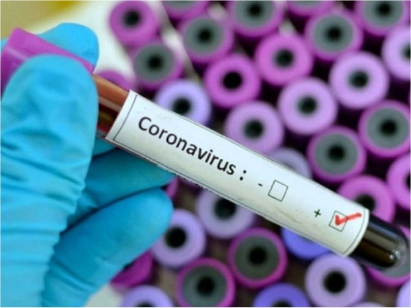 Paraguay, entre los países del mundo que realizan menos test