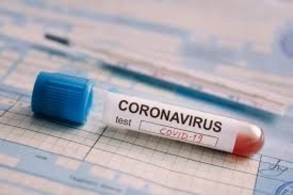 COVID-19: 'Este virus no es una gripecita cualquiera, creo que a nivel mundial se le subestimó', sostiene doctor