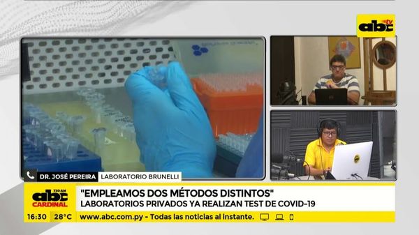 Bajac presentó nuevo test de covid-19 - ABC Noticias - ABC Color