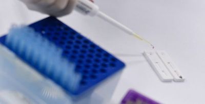 Rusia anuncia un nuevo test rápido para el virus