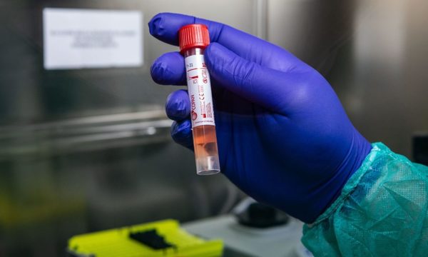 Laboratorio privado explica que tests pueden no detectar cargas virales cuando enfermedad va desapareciendo