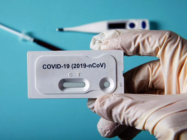 Argentina logra secuenciar genoma del coronavirus en pacientes locales